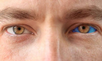 眼球纹身可能被禁止，难道奥克兰人不知道有美瞳？