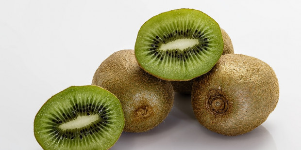 kiwifruit 400143 960 720
