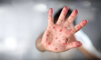麻疹疫情严重，美国发布赴新西兰旅行警告